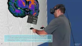 VBS - Virtual Brain Segmenter