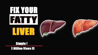 FATTY LIVER How to Fix It (Better than Any Pill)| Goodheath365