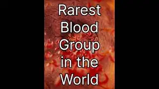 Rare blood group in the world 🩸🫀#shorts#bloodgroup#rare#shortsfeed