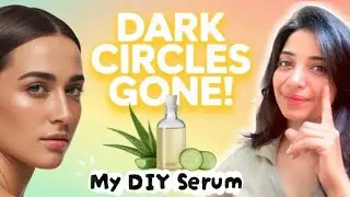 Dark Circles GONE in 7 Days ✨ | My DIY Serum that Actually Works 🌿| Part-1