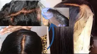 DIY: HOW TO BLEACH KNOTS PERFECTLY NATURAL LOOK |BEGINNER FRIENDLY|STEP BY STEP