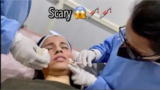 VLOG: PRP TREATMENT FOR FACE / Vampire Facial In India | Subcision Treatment for Pores & Scars