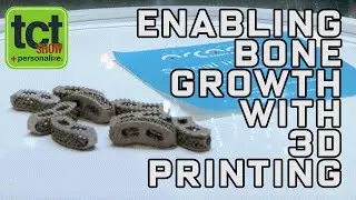 Enabling integrated bone growth with 3D printed metal implants