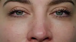 HydraFacial Platinum Experience at Amma Aesthetics | Full Treatment Process