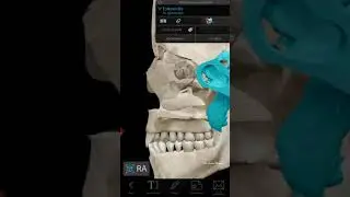 Cavidad Nasal - Paredes (Medial y  Lateral) - Anatom&iacute;a