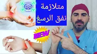 متلازمة النفق الرسغي carpal tunnel syndrome
