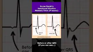Junctional Rhythms ECG Nursing Mnemonic NCLEX EKG Review