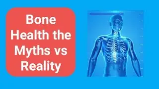 Bone Health the Myths vs Reality