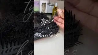 Types of Hair Loss - What Causes Hair To Fall Out & How to treat it#alopecia #hairfall #hairgrowth