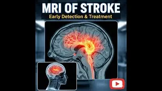 Day 2 Topic 4 MRI Of Stroke