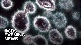 Experts suggest improving ventilation may reduce coronavirus spread