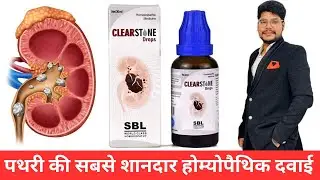 Kidney stone homeopathic medicine | Clear Stone drops | Dr Praveen Sharma