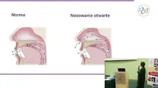 08 Największe pułapki logopedyczne w pracy z dziećmi z delecją 22q11