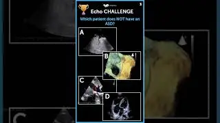 Echo Challenge: Which patient does not have an atrial septal defect? #congenitalheartdisease