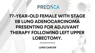 Expert Cancer Panel: Stage IIB lung adenocarcinoma presenting for adjuvant therapy s/p lobectomy