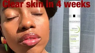 Bioderma night peel cleared my skin in under 4 weeks.