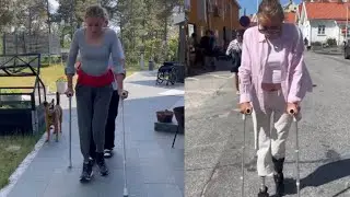 Amputee Lady Life After Amputation: Crutches and Prosthetic walking Journey 