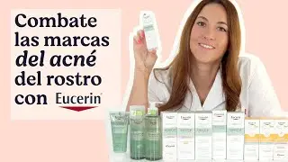 ¿Problemas con el ACNÉ? Rutina en TRES PASOS con ✨EUCERÍN✨ @ Atida | Mifarma