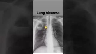 #chest position and image radiology @x ray #x ray adda 123