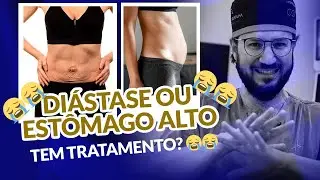 DIÁSTASE OU ESTÔMAGO ALTO, TEM TRATAMENTO? O QUE FAZER?