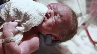 removing amniyatc fluids from newborn NICU baby 