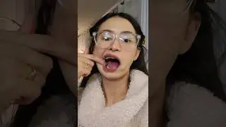 Why Is Her Mouth Is FULL Of METAL!? 😳🦷