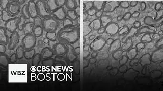 Harvard Medical School Alzheimer's research finds lithium improves memory in mice