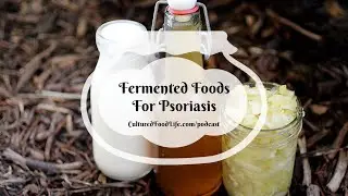Podcast Episode 326: Fermented Foods For Psoriasis
