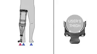 iWALK2.0 Fitting - Adjust For Your Leg Type