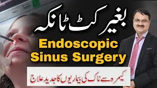 Endoscopic Sinus Surgery | Modern Camera-Based Treatment for Sinus Problems