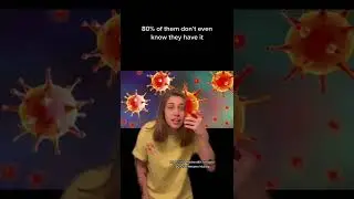 YOU MIGHT HAVE HERPES 🦠 w OnlyJayus - #Shorts