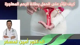 كيف تؤثر على الحمل بطانة الرحم المهاجرة الدكتور أمين لمسفر