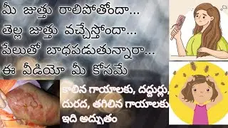 జుత్తు సమస్యలకు, చర్మ సమస్యలకు ఒక అద్భుతమైన ఆయుర్వేద యోగం #hairfall #skincare#hairgrowth#skinitching
