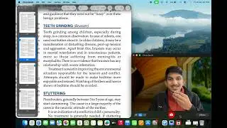 TEETH GRINDING BRUXISM PAEDIATRICS MD