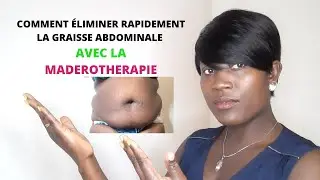 MADEROTHERAPIE CORPS | COMMENT &Eacute;LIMINER LA GRAISSE ABDOMINALE RAPIDEMENT? BY CHRISMONDE BEAUTY