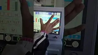 Fixing the 'Large Bubble Error' on Nipro Surdial 55Plus Dialysis Machine in Seconds #QuickFix #Nipro