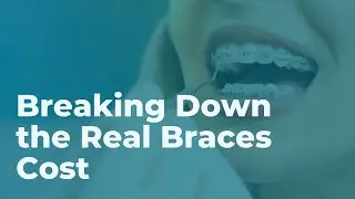 How Much Do Braces Cost? What to Expect in Chula Vista