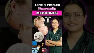 Acne & Pimples Best Homeopathy Medicines ⚕️