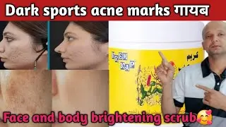 Krem kap Best scrub for darksports | Acne marks treatment