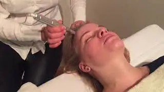Valya Beauty:  Micro-needling / Ny kosmetikk teknologi