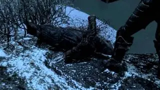 F*cking Badass Viking Part 3 & Dental Appointments | Inspired by Robbaz [Skyrim]