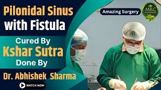 Pilonidal Sinus with Fistula | Cured By Kshar Sutra | Done By Dr. Abhishek  Sharma | Mrc Ayurveda