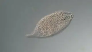 Maybe Ciliate Trachelophyllum  200x