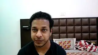 Mobile number and Progress report of my hair transplant on Day 170 - 22nd May 2021