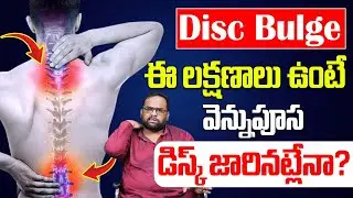 ఈ లక్షణాలు ఉంటే వెన్నుపూస డిస్క్ జారినట్లేనా? | Disc bulge Problem Causes And Symptoms in Telugu