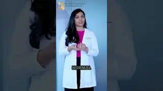 Top Dermat Dr Ravali explains : Keloid vs. Hypertrophic Scars: What's the Difference
