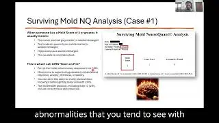 The &ldquo;Brain on Fire&rdquo; Pattern in CIRS