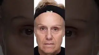 Plumping Serum Results | How to Plump Fine Lines | Hyaluronic Acid Before and After #Shorts
