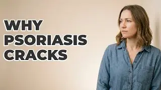 What Causes Dry, Cracked Skin From Psoriasis?