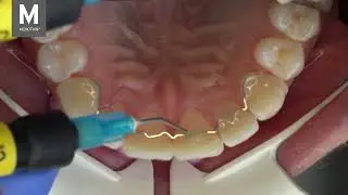 Klinischer Klebefilm SCHEU MEMOTAIN&reg; - Dr. Pascal Schumacher
